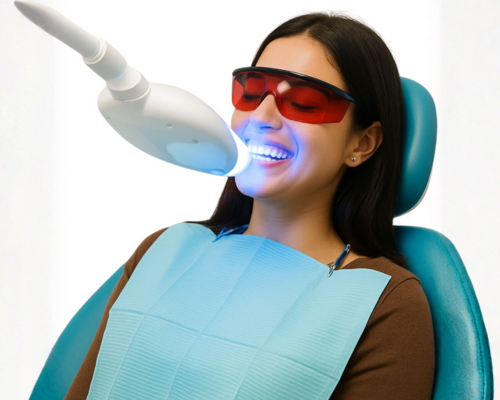 Laser Teeth Whitening Mysore